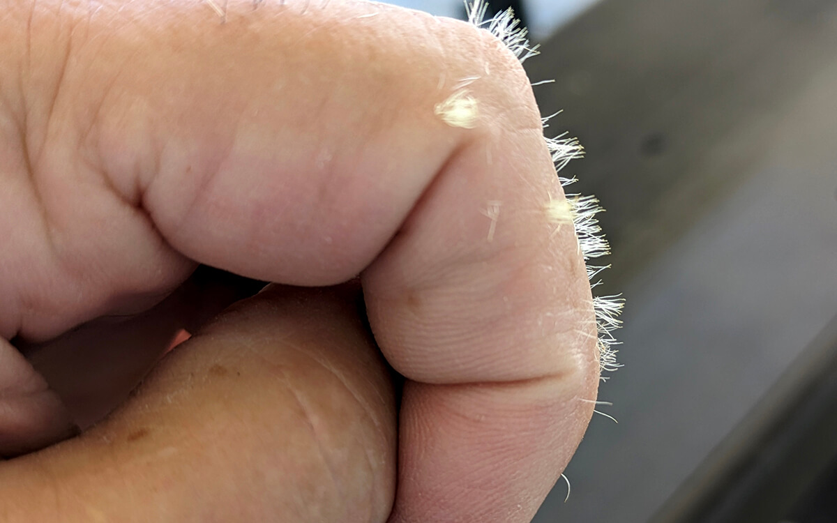 glochids stuck in fingers